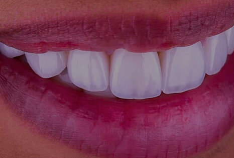 Bild der Zahnarztpraxis Waldstrasse in Erlangen: Ein Lächeln zeigt gesunde und weiße Zähne